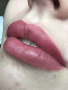 image-03-02-21-11-44